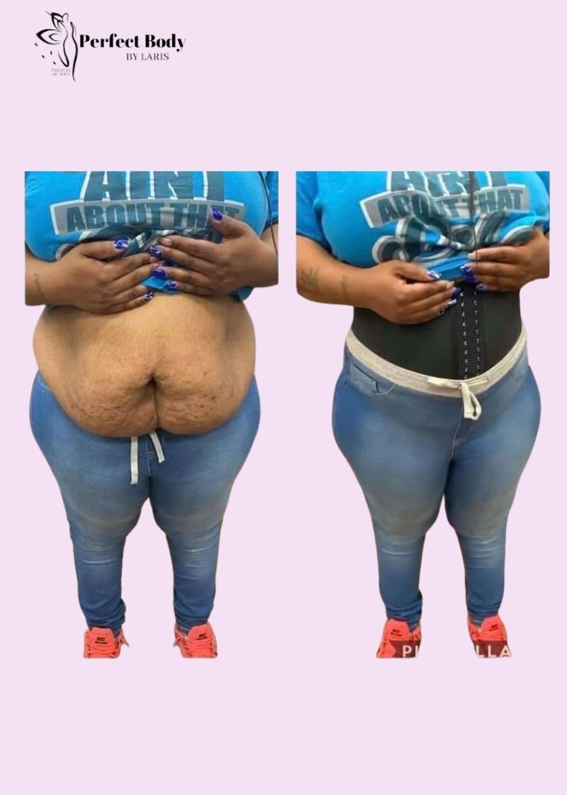 Corset minceur 25 os d’acier en latex Ancien Modèle – Image 8