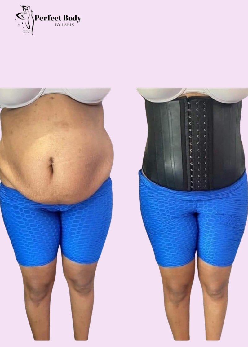 Corset minceur 25 os d’acier en latex Ancien Modèle – Image 6